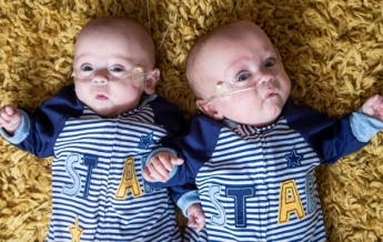 Британка родила наименьших в мире близнецов (фото, видео)
