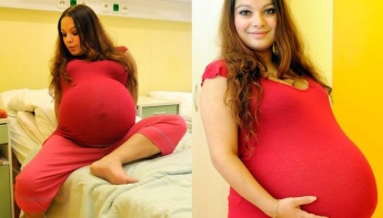 23-річна дівчина була впевнена, що чекає на близнюків. Але дізнавшись результати УЗД заплакала.. (фото)