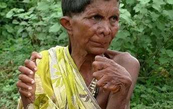 Из-за 31 пальца женщину считают ведьмой (фото)
