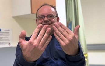 Британцу пришили палец ноги вместо пальца руки (фото 18+)