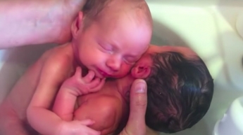 Новонароджені близнюки відмовляються переставати обіймати один одного навіть після народження
