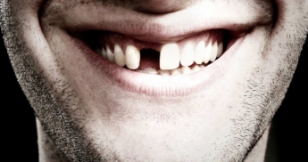 Количество выпавших зубов поможет определить оставшуюся продолжительность жизни человека