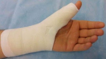 Житель Мелитополя сломал соседке палец