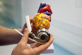 В больнице Киева впервые имплантировали механическое сердце (видео)
