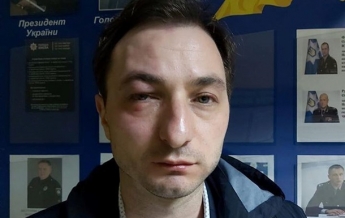 Главврача Нацинститута рака избили в Киеве (видео, фото)