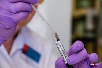 В Запорожской области проверили 12 человек с подозрением на коронавирус