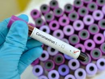 В конце недели Запорожье получит тест-системы для выявления коронавируса