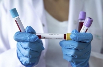 В Украине зафиксировано 2 новых случая коронавируса - МОЗ