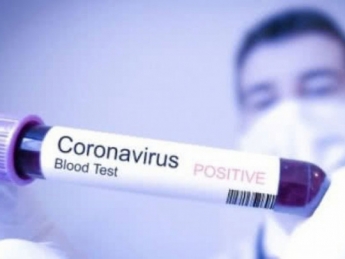 Село в Черниговской области объявили очагом вспышки коронавируса