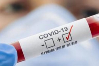 Результат за пять минут: в США запускают производство революционных тестов на коронавирус
