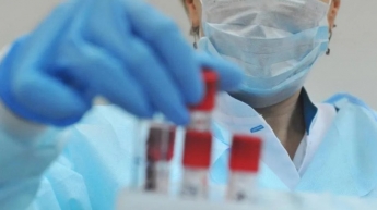 В Запорожской области уже 13 случаев коронавируса