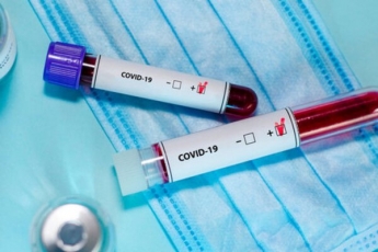 Как пройти тест на коронавирус при отказе врача: Минздрав дал инструкцию (видео)
