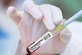 Количество заболевших в Запорожской области перевалило за сотню