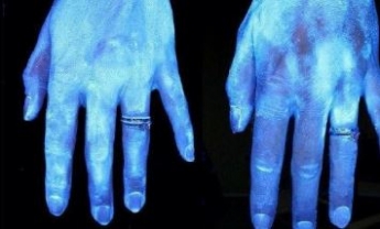 Что происходит с бактериями на руках, если их плохо помыли: появились наглядные фото