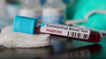 Сколько стоят тесты на коронавирус в аптеках в Запорожской области