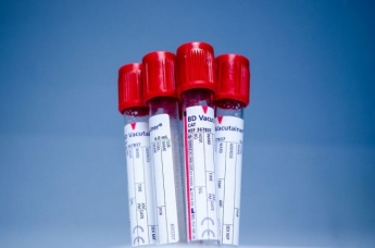 Люди с какой группой крови чаще заражаются COVID-19