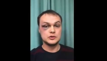 В Харькове нарушители карантина избили и ограбили журналиста: фото и видео