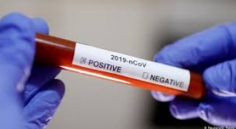 Иммунитет нужно "подавлять": ученые нашли неожиданное спасение от коронавируса