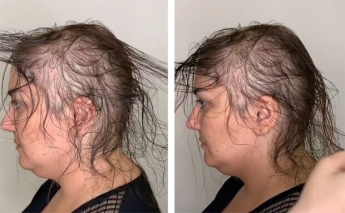 Парикмахер спасла внешность женщины, сделав из редких волос великолепную прическу