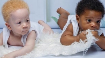 Девушка родила близнецов с разным цветом кожи. Теперь ей не верят, что оба ребенка ее