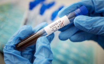 В Украине появился простой тест для определения антител к коронавирусу