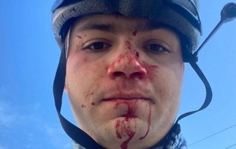 В Киеве избили велосипедиста, помешавшего машине проехать по тротуару (фото)