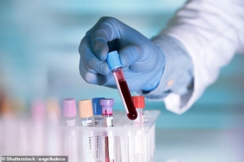 Новый золотой стандарт: британские ученые сделали прорыв в диагностике и отслеживании рака