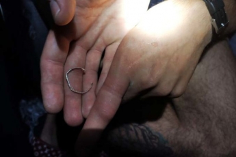 Мог лишиться пальца: в Днепре кольцо застряло на пальце руки молодого парня