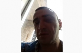 Жестоко избитый житель Мелитополя утверждает, что в него стреляли в центре города (видео)