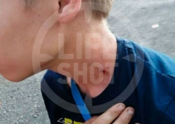 Женщина решила заступиться за сына и воткнула гвоздь ребенку в шею (фото)