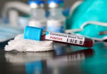 В Запорожской области зарегистрировано 10 новых случаев коронавируса
