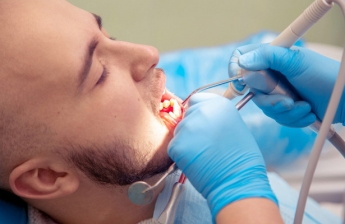 Правда ли, что зубной камень может привести к выпадению зубов 