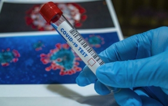 Позитивний та негативний вплив коронавірусу на життя людей в Україні