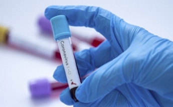 В Мелитополе продолжают выявлять новые случаи коронавируса. Обновленные данные