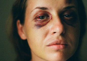 Как сейчас себя чувствует девушка, которую жестоко избили в поезде из Запорожья в столицу (фото)