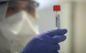 В Мелитополе уже 123 подтвержденных лабораторно случаев коронавируса