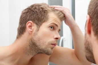 Выпадение волос у мужчин: причины, способы решения проблемы