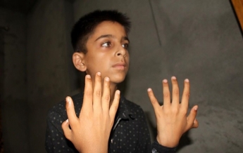Мальчику из Индии лишние пальцы помогают достигать успехов (фото, видео)
