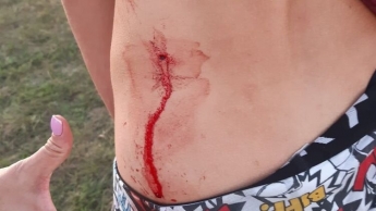 Бывший депутат ударил подростка отверткой за езду на мотоцикле у школьного стадиона. Фото