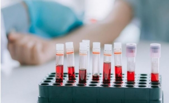 Что нужно знать, чтобы правильно сдать общий анализ крови в Москве