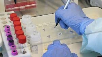 В Запорожье анализ на коронавирус снова можно сдать в государственной лаборатории
