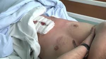 В Запорожской области парня ударили ножом в живот