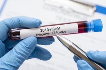 Сколько в Мелитополе за сутки новых случаев коронавируса выявили