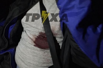 В Харькове произошла кровавая стрельба из-за девушки: фото