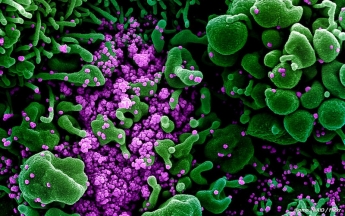 Ученые обнаружили новый вид коронавируса, поражающий клетки кишечника