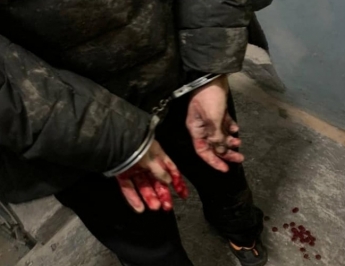 В Запорожье задержали 17-летнего парня, ранившего патрульного (фото)