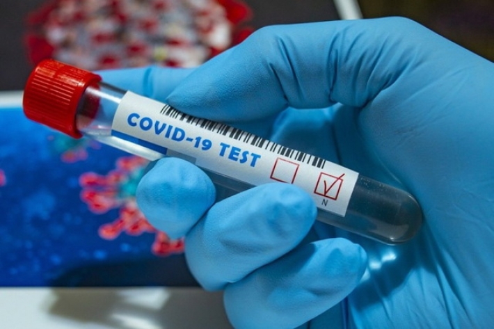 В Мелитополе подтвердили еще одну смерть от коронавируса