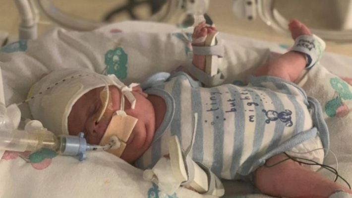 Младенец чудом выжил после коронавируса и других опасных болезней - весил менее 800 грамм: фото