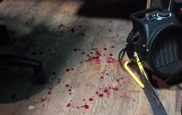 "Напали сзади": в Черкассах чиновник мэрии с помощником избил журналиста