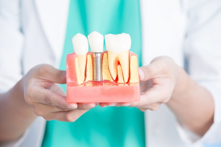 В Мелитополе пациент потребовал бесплатно поставить ему импланты в городской стоматологии